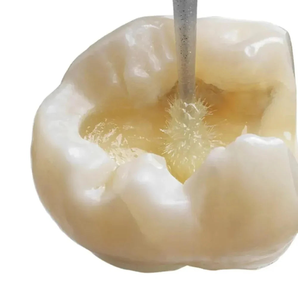 Wizdent Select Bond TE 5th Generation Dental Adhesive