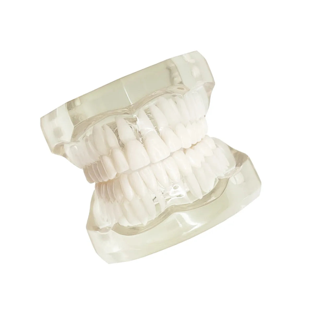 JJ Ortho Class II Division I Orthodontic Model (10.10.02)